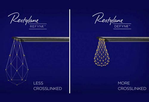 What is Restylane® Refyne?