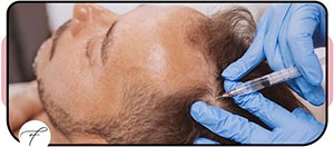 Hair Restoration Treatment Near Me in Las Vegas, NV Hair Restoration Treatment Near Me in Las Vegas, NV