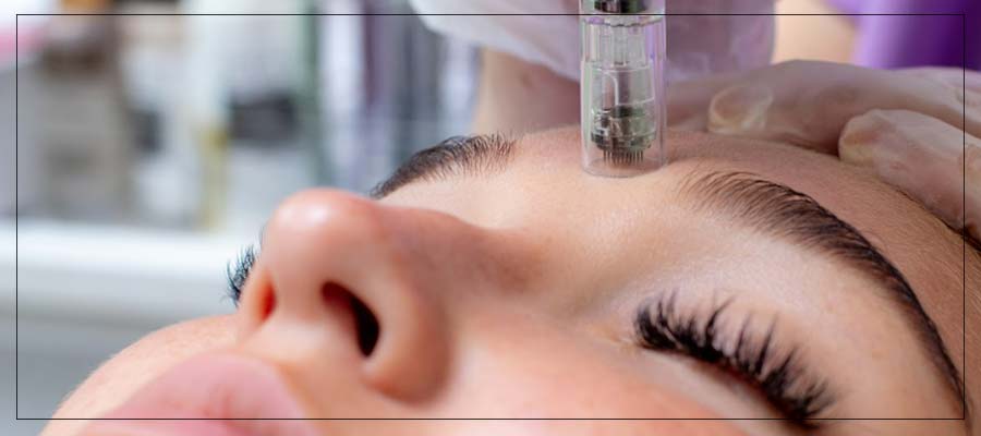 Microneedling Advanced Esthetic Specialist Near Me in Las Vegas, NV Microneedling Advanced Esthetic Specialist Near Me in Las Vegas, NV
