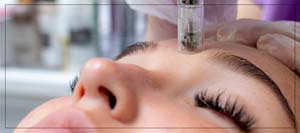 Microneedling Advanced Esthetic Specialist Near Me in Las Vegas, NV Microneedling Advanced Esthetic Specialist Near Me in Las Vegas, NV