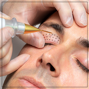Plasma IQ Pen Treatment Specialist Near Me in Beverly Hills, CA and Las Vegas, NV
