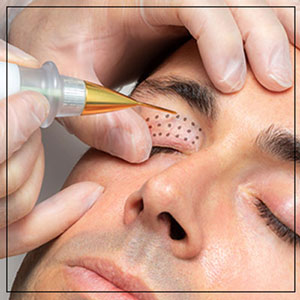 Plasma IQ Pen Treatment Specialist Near Me in Las Vegas, NV Plasma IQ Pen Treatment Specialist Near Me in Las Vegas, NV