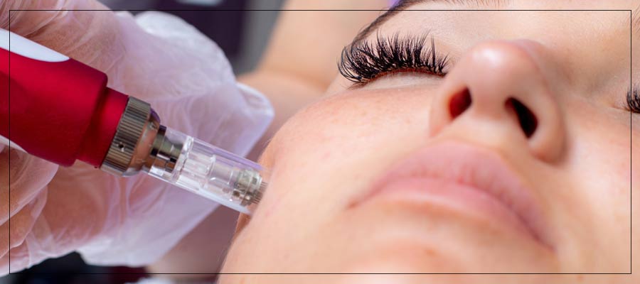 Vampire Facial Specialist Near Me in Beverly Hills, CA and Las Vegas, NV Vampire Facial Specialist Near Me in Beverly Hills, CA and Las Vegas, NV