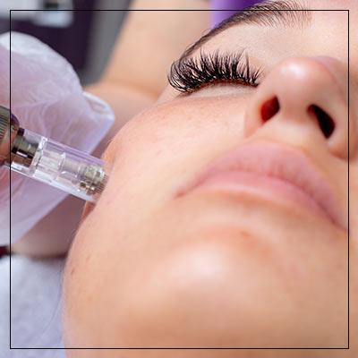 Vampire Facial Treatment Near Me in Las Vegas, NV Vampire Facial Treatment Near Me in Las Vegas, NV
