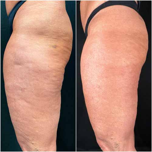 Scarlet SRF Treatment Specialist Near Me in Las Vegas, NV Scarlet SRF Treatment Specialist Near Me in Las Vegas, NV