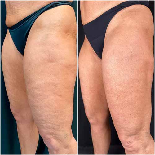 Scarlet SRF Treatment Specialist Near Me in Las Vegas, NV Scarlet SRF Treatment Specialist Near Me in Las Vegas, NV