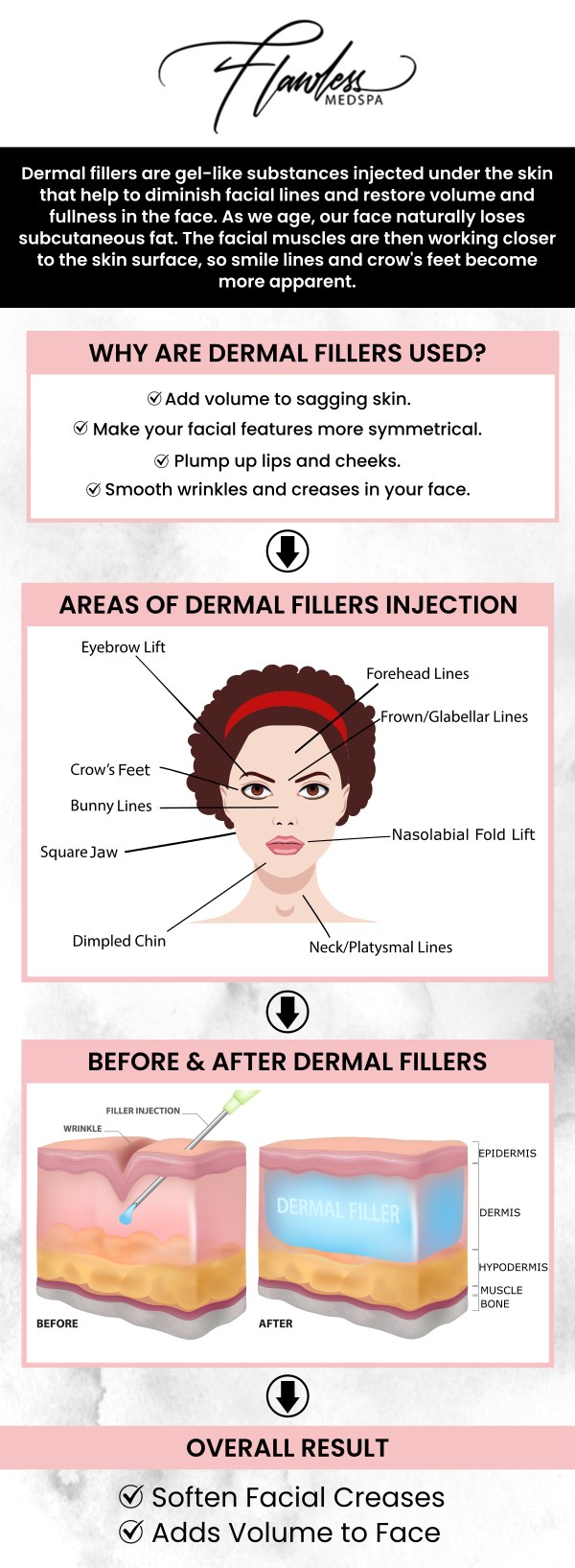 Smooth out your skin and get rid of fine lines and wrinkles with Dermal Fillers. Talk to our team of professionals at Flawless Medspa about the benefits of Dermal Fillers. Contact us today or visit us online to book an appointment. Our med spa is located at 9418 W. Lake Mead Blvd Las Vegas, NV 89134.