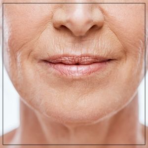 Lip Filler Specialist Near Me in Beverly Hills, CA and Las Vegas, NV