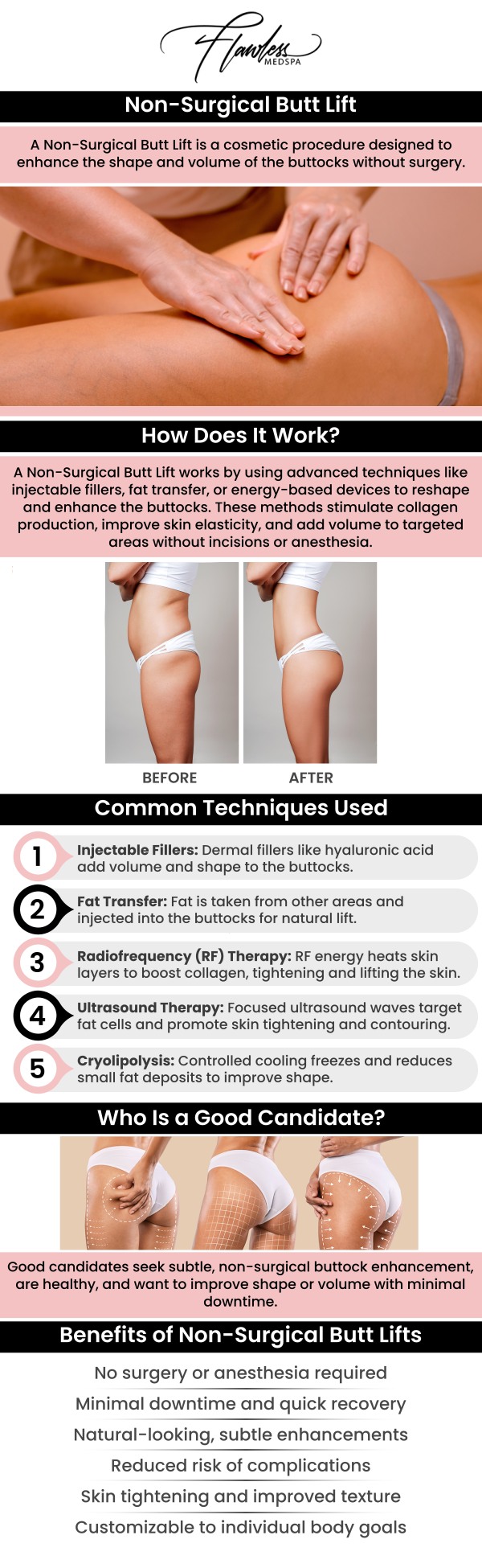 A non-surgical butt lift is a great way to subtly enhance your shape and achieve a more lifted, contoured appearance without the need for surgery. At The Beverly Hills MedSpa, Melanie Speed, APRN, NP-C, CANS, provides customized treatments designed to refine your look with minimal recovery time. Using modern techniques, we help you achieve natural-looking, confidence-boosting results tailored to your unique goals. For more information, contact us today and schedule an appointment online. We are conveniently located at 435 N Roxbury Drive Suite 100, Beverly Hills, CA 90210.