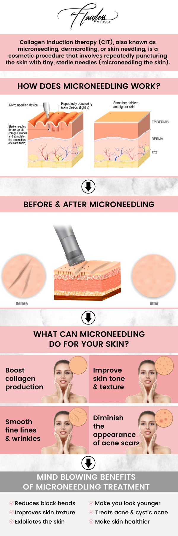 Microneedling is a popular treatment for improving skin texture and reducing the appearance of fine lines, scars, and wrinkles. The cost of microneedling can vary depending on the treatment area and the number of sessions required to achieve optimal results. The cost of microneedling in Las Vegas, NV, typically ranges from $200 to $500 per session. At Beverly Hills Medspa, Melanie Speed, APRN, NP-C, CANS, will provide a customized plan to ensure you receive the best value for your investment in radiant, youthful skin. For more information, contact us today and schedule an appointment online. We are conveniently located at 435 N. Roxbury Drive, Suite 311. Beverly Hills, CA 90210. Microneedling is a popular treatment for improving skin texture and reducing the appearance of fine lines, scars, and wrinkles. The cost of microneedling can vary depending on the treatment area and the number of sessions required to achieve optimal results. The cost of microneedling in Las Vegas, NV, typically ranges from $200 to $500 per session. At Beverly Hills Medspa, Melanie Speed, APRN, NP-C, CANS, will provide a customized plan to ensure you receive the best value for your investment in radiant, youthful skin. For more information, contact us today and schedule an appointment online. We are conveniently located at 435 N. Roxbury Drive, Suite 311. Beverly Hills, CA 90210.