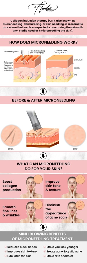 Microneedling is a powerful treatment that rejuvenates your skin, but proper aftercare is essential to maximize the results. After microneedling, it's important to follow specific steps to ensure your skin heals beautifully and you achieve the best possible outcome. At The Flawless Medspa and Beverly Hills MedSpa, Melanie Speed, APRN, NP-C, CANS, and our team are here to help you maintain your results and support the healing process. By following our aftercare instructions, you’ll enjoy smoother, more youthful-looking skin and make the most of your microneedling treatment. Contact us today for more information or schedule your appointment online. We have convenient locations to serve you in Las Vegas, NV and Beverly Hills, CA. Microneedling is a powerful treatment that rejuvenates your skin, but proper aftercare is essential to maximize the results. After microneedling, it's important to follow specific steps to ensure your skin heals beautifully and you achieve the best possible outcome. At The Flawless Medspa and Beverly Hills MedSpa, Melanie Speed, APRN, NP-C, CANS, and our team are here to help you maintain your results and support the healing process. By following our aftercare instructions, you’ll enjoy smoother, more youthful-looking skin and make the most of your microneedling treatment. Contact us today for more information or schedule your appointment online. We have convenient locations to serve you in Las Vegas, NV and Beverly Hills, CA.