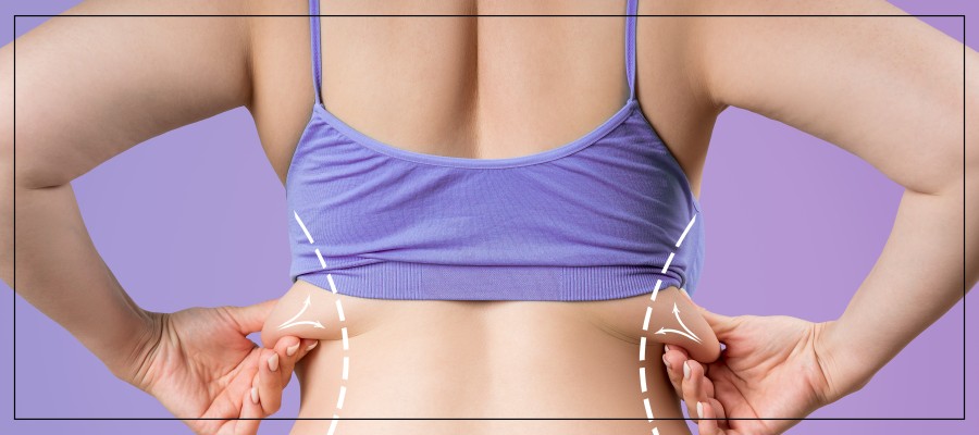 Bra Bulge Fat Reduction Specialist Near Me in Las Vegas, NV and Beverly Hills, CA Bra Bulge Fat Reduction Specialist Near Me in Las Vegas, NV and Beverly Hills, CA