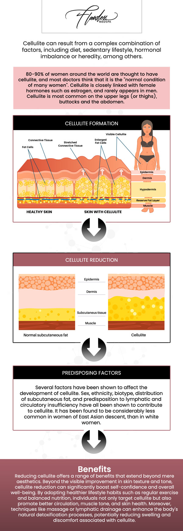 Common questions asked by clients: What causes cellulite? Who is a good candidate for cellulite reduction treatments? How many sessions will I need for cellulite reduction, and when will I see results? How long do the results of cellulite reduction last?
Cellulite reduction treatments, offered by Melanie Speed, APRN, NP-C, CANS, at Flawless MedSpa & The Beverly Hills MedSpa, target the underlying causes of cellulite for smoother, firmer skin. Using advanced technologies, these treatments help reduce the appearance of cellulite. Achieve noticeable results with personalized care from a skilled professional. For more information, please contact us or schedule an appointment online. We have convenient locations to serve you in Las Vegas, NV and Beverly Hills, CA. We serve clients from Las Vegas NV, Summerlin South NV, Paradise NV, Winchester NV, Beverly Hills CA, Los Angeles CA, Santa Monica CA, Burbank CA, and surrounding areas.