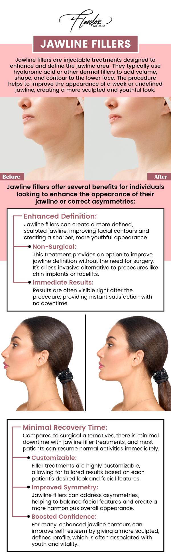Jawline filler is a non-surgical treatment designed to enhance the contours of your jawline, providing a more defined and youthful appearance. Melanie Speed, a top aesthetic injector at The Beverly Hills MedSpa, uses precise injection techniques to sculpt the jawline and restore facial balance. This treatment is ideal for individuals looking to improve their facial structure with minimal downtime. With expert application, jawline fillers can subtly redefine the lower face and create a more harmonious profile. For more information, contact us today and schedule an appointment. We are conveniently located at 435 N Roxbury Drive, Suite 100, Beverly Hills, CA 90210. Jawline filler is a non-surgical treatment designed to enhance the contours of your jawline, providing a more defined and youthful appearance. Melanie Speed, a top aesthetic injector at The Beverly Hills MedSpa, uses precise injection techniques to sculpt the jawline and restore facial balance. This treatment is ideal for individuals looking to improve their facial structure with minimal downtime. With expert application, jawline fillers can subtly redefine the lower face and create a more harmonious profile. For more information, contact us today and schedule an appointment. We are conveniently located at 435 N Roxbury Drive, Suite 100, Beverly Hills, CA 90210.