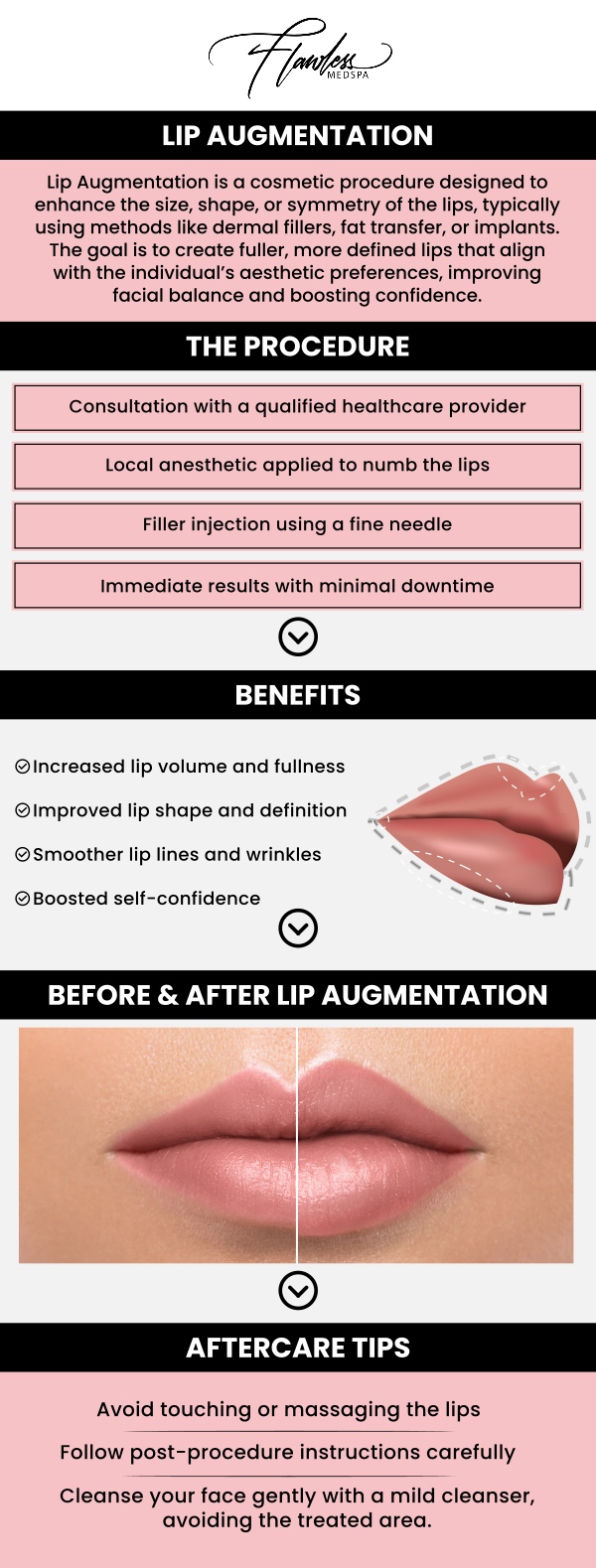 Lip augmentation is a popular non-surgical procedure designed to enhance the shape, volume, and symmetry of the lips. During the treatment, fillers are used to add volume and contour to your lips. The procedure takes less than an hour and is typically painless. Final results are visible in 1-2 weeks, leaving your lips fuller and more defined. At Flawless MedSpa & The Beverly Hills MedSpa, Melanie Speed, APRN, NP-C, CANS, ensures a personalized and comfortable experience, helping you achieve natural-looking, beautiful results. Whether you seek subtle enhancement or more dramatic volume, the procedure is customized to your unique facial features for the best outcome. Contact us today for more information or book an appointment online. We have convenient locations to serve you in Las Vegas, NV and Beverly Hills, CA. Lip augmentation is a popular non-surgical procedure designed to enhance the shape, volume, and symmetry of the lips. During the treatment, fillers are used to add volume and contour to your lips. The procedure takes less than an hour and is typically painless. Final results are visible in 1-2 weeks, leaving your lips fuller and more defined. At Flawless MedSpa & The Beverly Hills MedSpa, Melanie Speed, APRN, NP-C, CANS, ensures a personalized and comfortable experience, helping you achieve natural-looking, beautiful results. Whether you seek subtle enhancement or more dramatic volume, the procedure is customized to your unique facial features for the best outcome. Contact us today for more information or book an appointment online. We have convenient locations to serve you in Las Vegas, NV and Beverly Hills, CA.