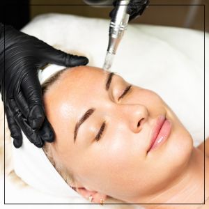Microneedling Treatment Specialist in Beverly Hills, CA