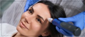 Microneedling with PRP Treatment in Las Vegas, NV