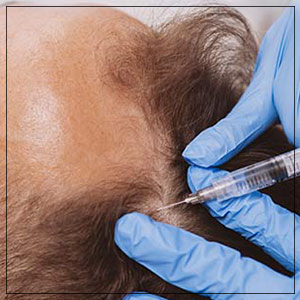 Hair Restoration Treatment Specialist in Las Vegas, NV