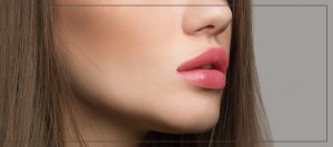 Russian Lip Fillers in Beverly Hills, CA Russian Lip Fillers in Beverly Hills, CA